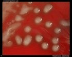 streptococcus pneumoniae